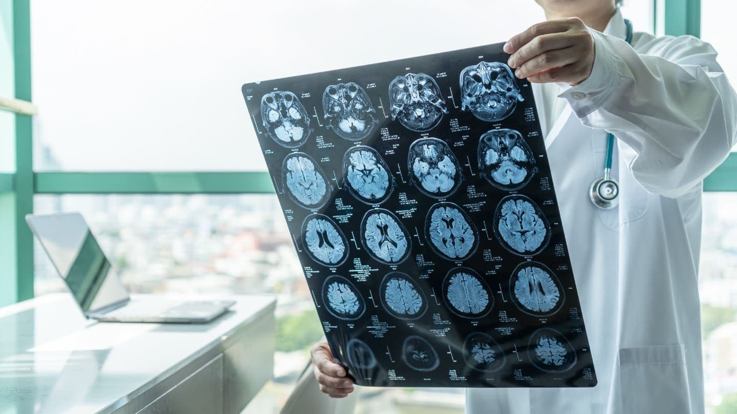 VA & Military Brain Injury Claims